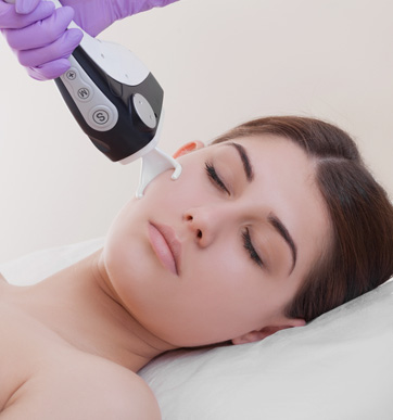 Fractionated CO2 Laser Treatment Beverly Hills, CA - Moy, Fincher